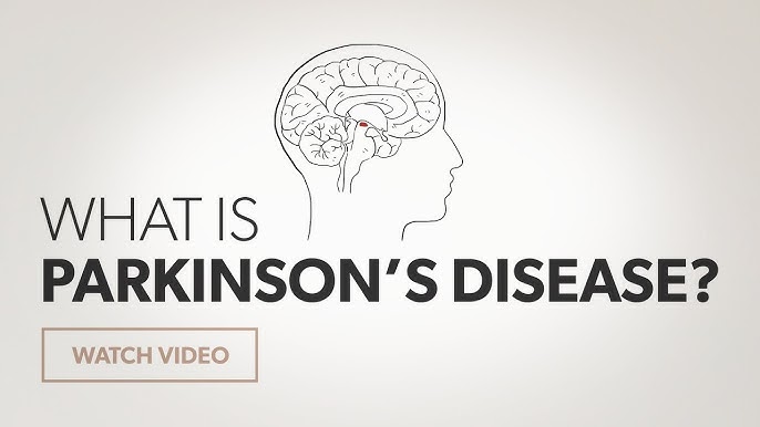 Can Mold Exposure Lead to Parkinson’s-Like Symptoms in 2024? Findings Indicate Possibility